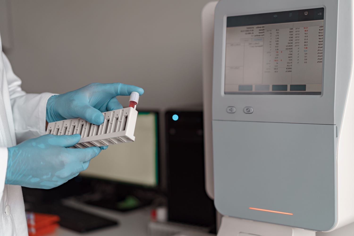 STD PCR test